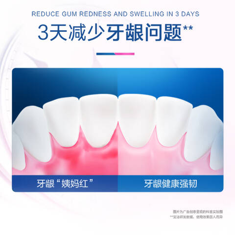 Oral-B/欧乐B 牙膏 牙龈专护对抗红肿出血 90g